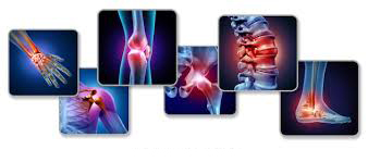 Degenerative Arthritis: Let's reclaim your mobility