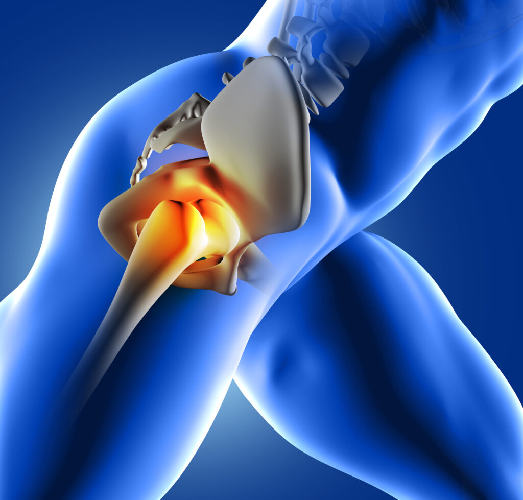 Get back on your feet with expert hip joint care!