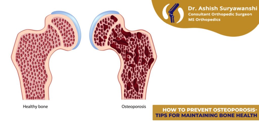 How to Test for Knee Ligament Injury : A Comprehensive Guide