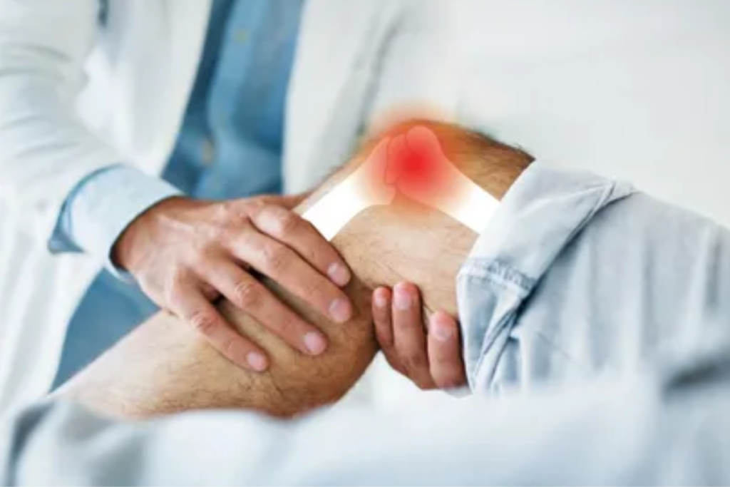 Understanding Arthritis of the Knee: Causes, Symptoms, and Treatment