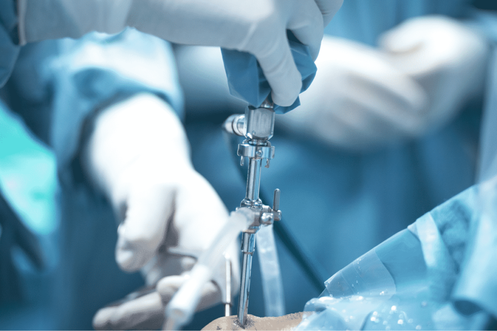 Exploring Mini-Invasive Orthopedic Surgery