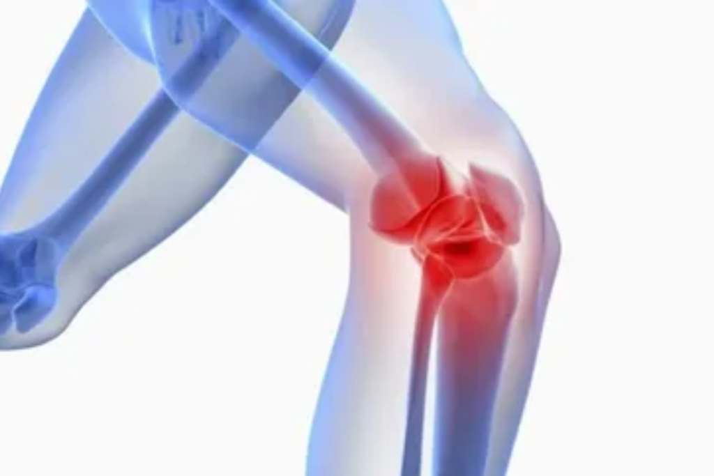 degenerative arthritis in Pune