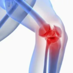 degenerative arthritis in Pune